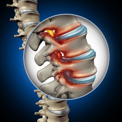 Mid & Lower Back Conditions