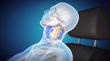 Spine trauma treatment