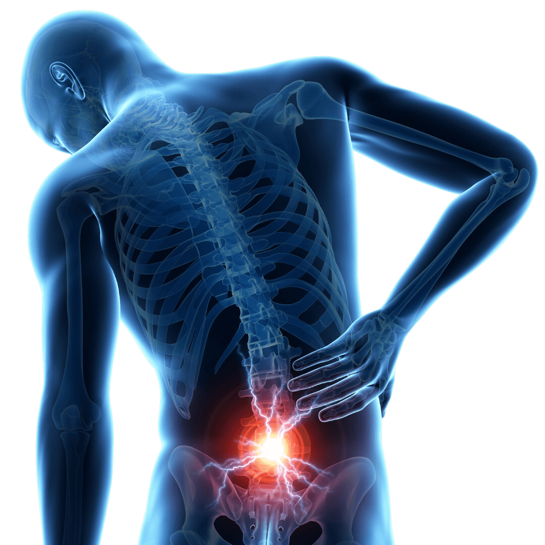 Sciatica treatment