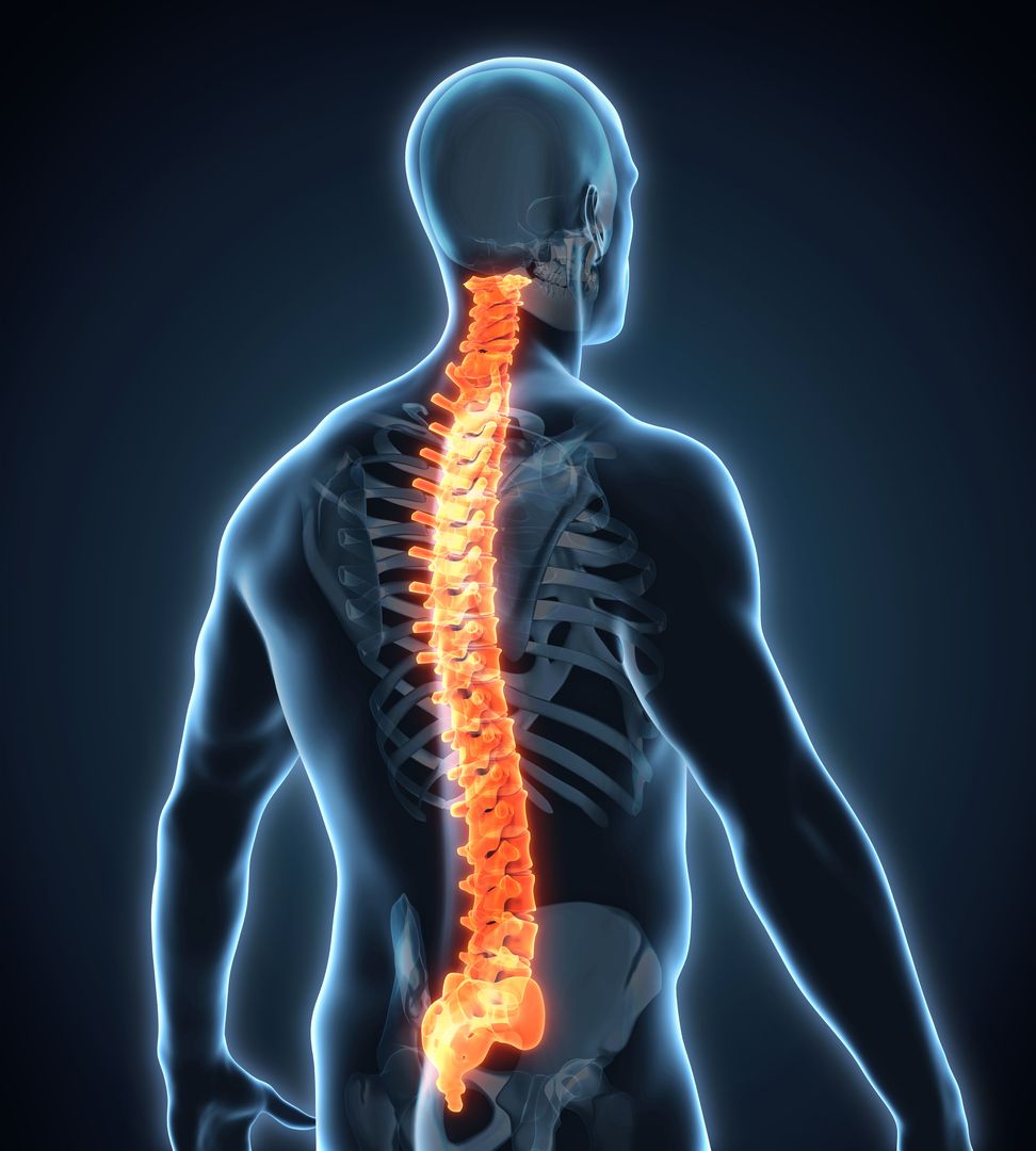 Mid-Back Spinal Cord Pressure
