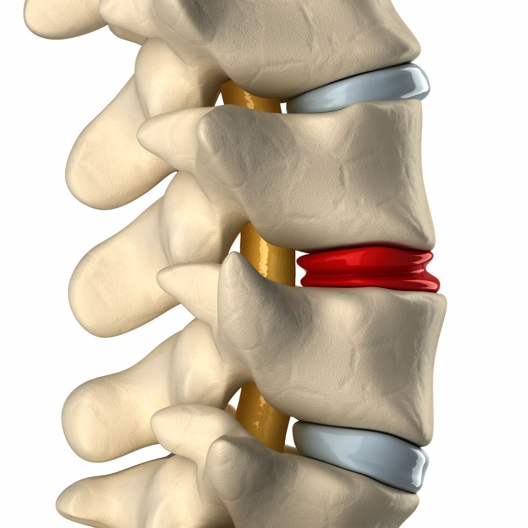 Thoracic causes