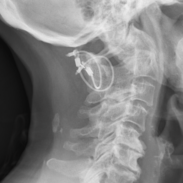 Neurological Safety