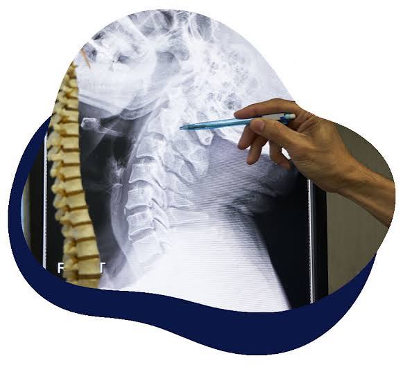Deformity Correction