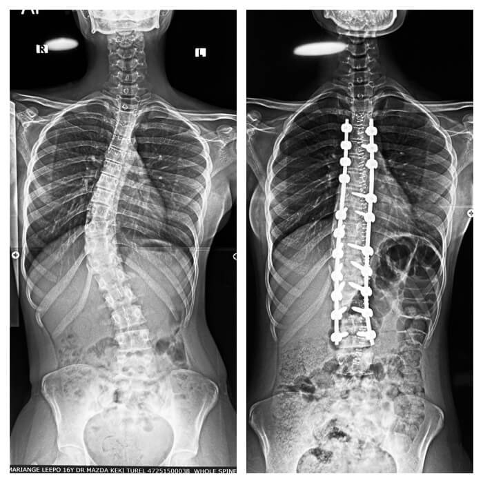 Intraoperative Navigation