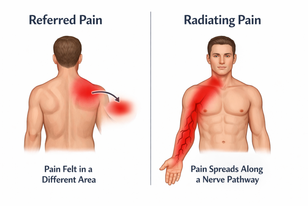 Sciatica pain