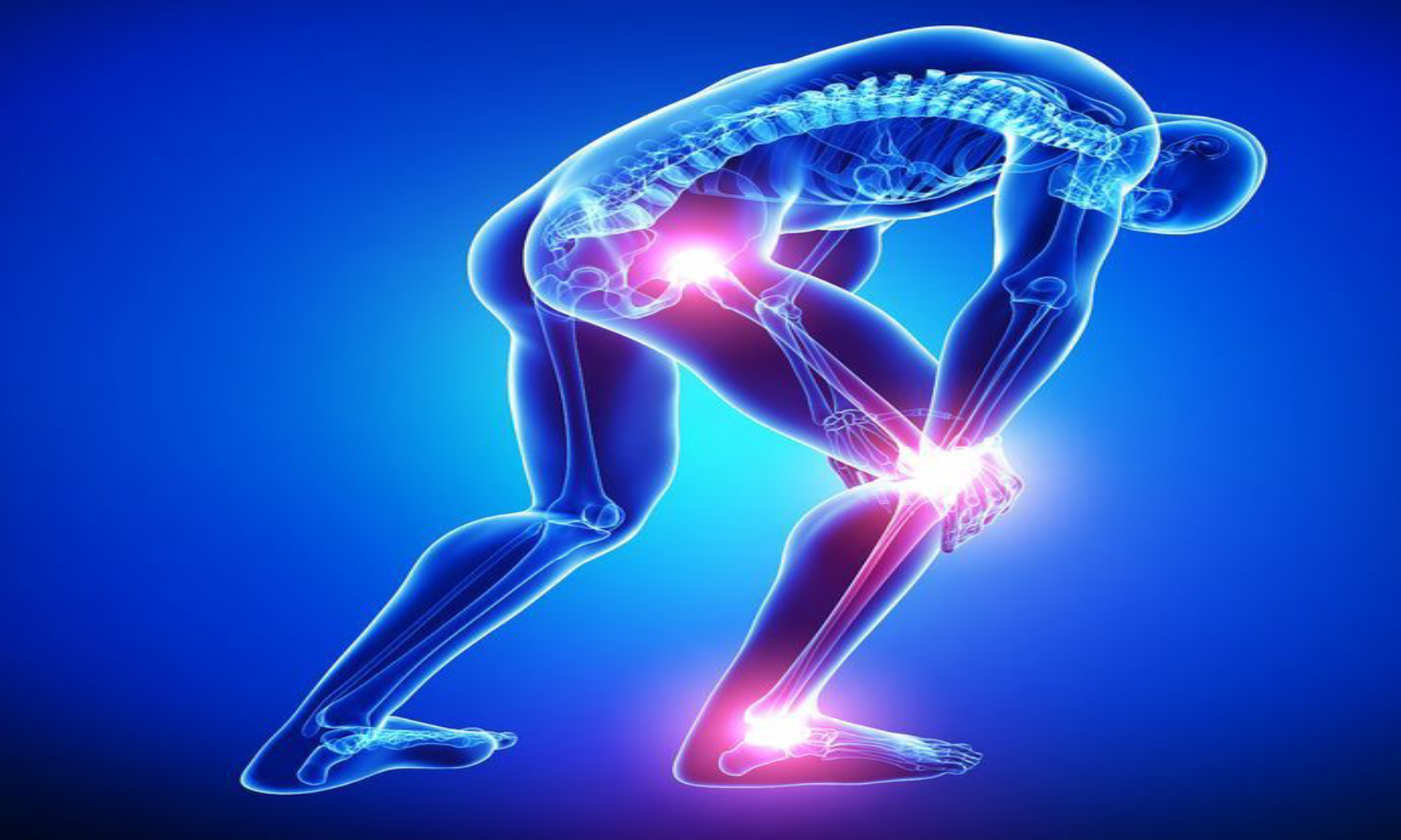 Sciatica Leg Pain