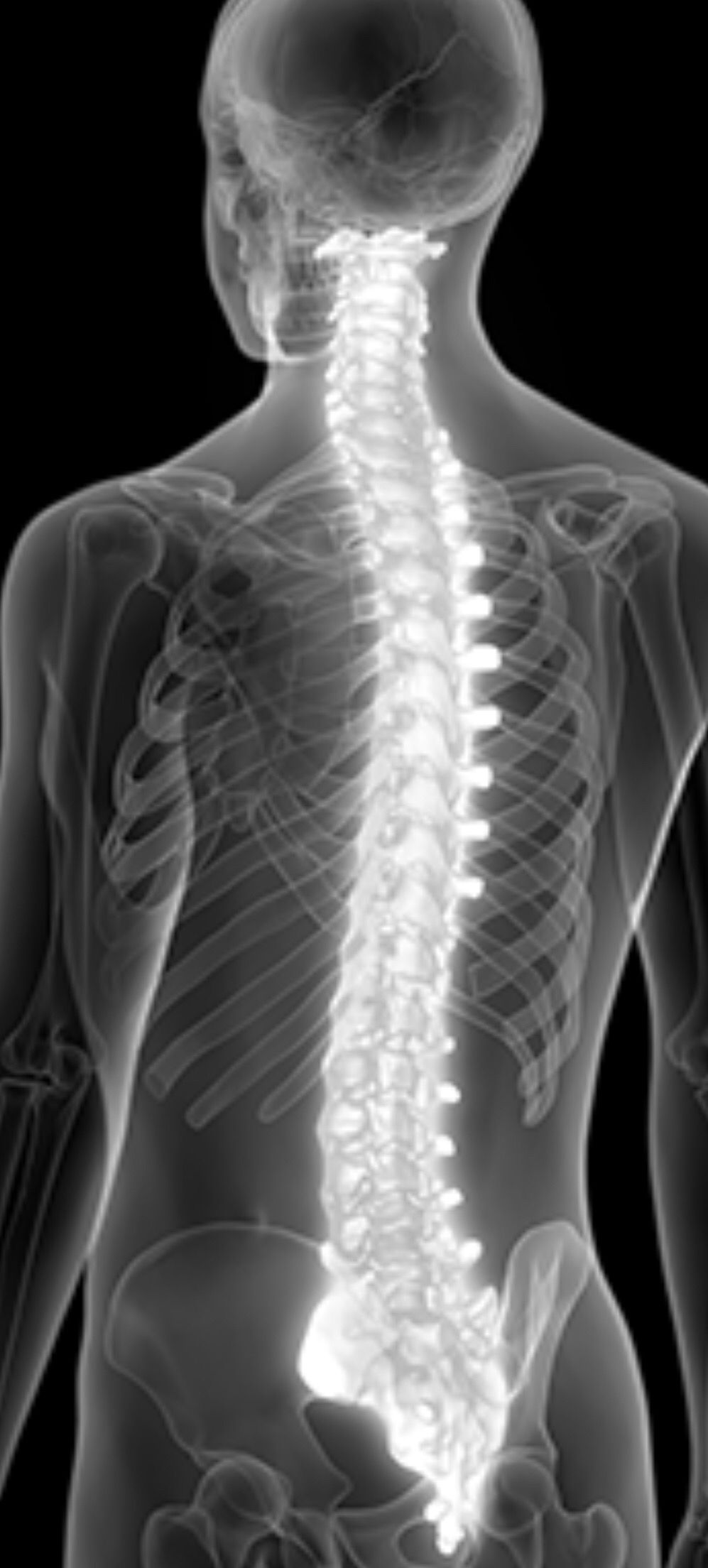 Spine scans