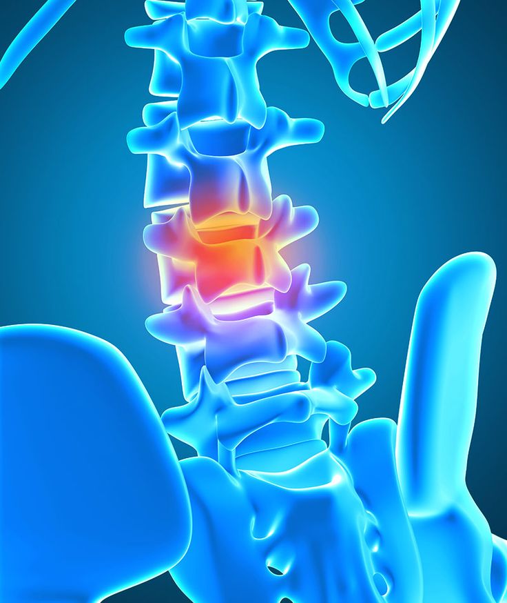 Spine consultation