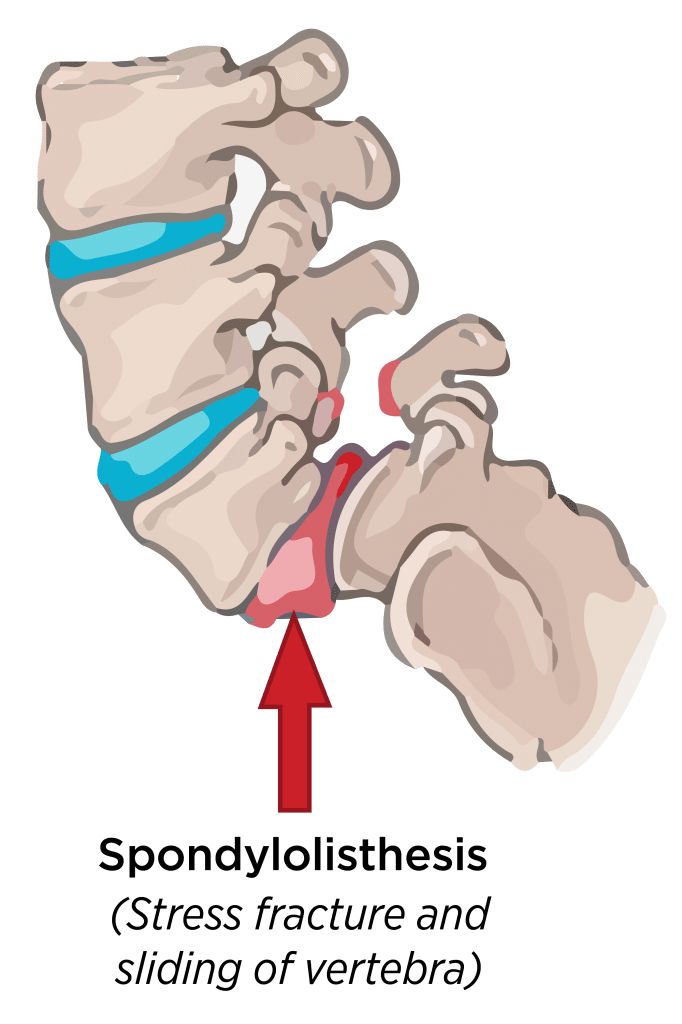 Symptoms